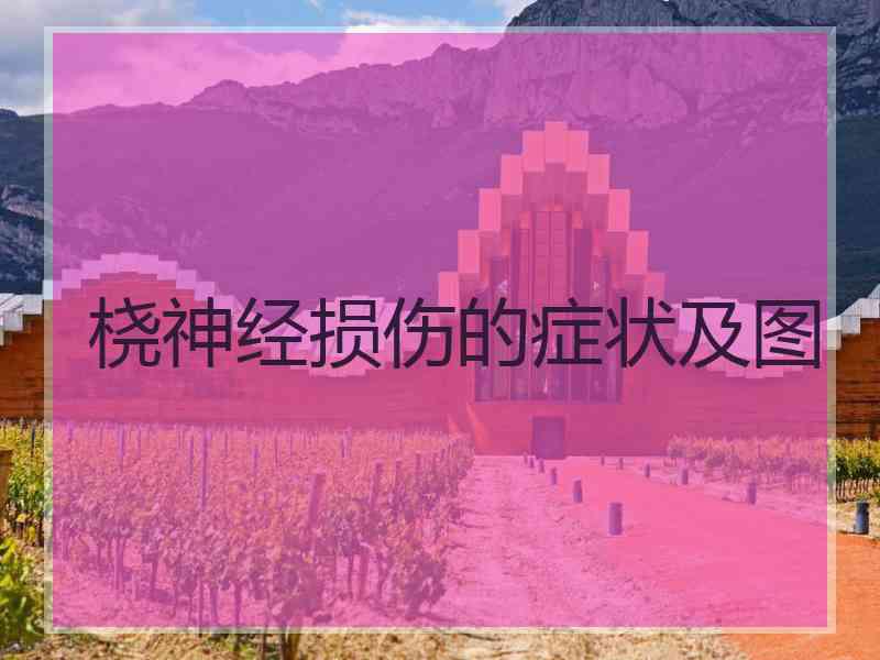 桡神经损伤的症状及图